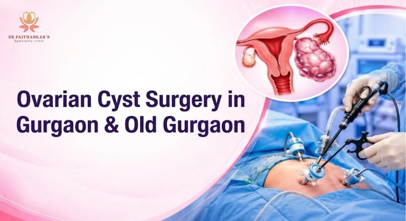 Laparoscopic ovarian cyst surgery procedure